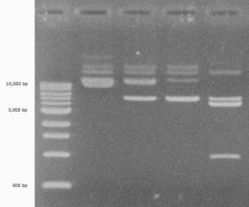 dna gel etidium